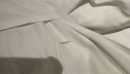 网友称女儿被酒店枕头里的针扎伤，酒店：已报警