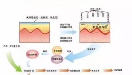 什么是干敏？什么是油敏？什么是激素敏？？