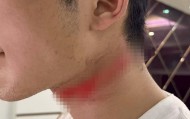男主播骑车载女友回家被路边掉落网线勒伤脖子，索赔3万陷僵局 律师解读该谁赔
